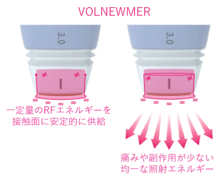 ボルニューマのしくみ